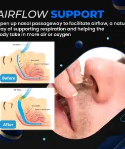 NoSnore™ Anti Snoring Device 2.webp